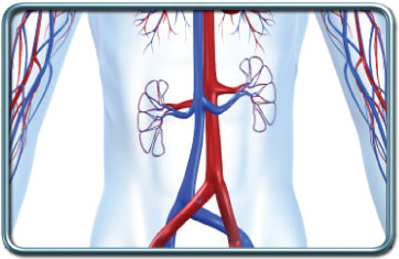 ניתוח אורטה בטנית