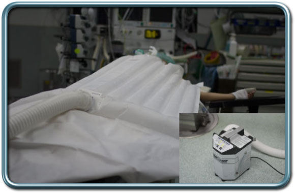 Bair hagger- שמיכת חימום המחוממת באמצעות אויר חם המוזרם דרכה bair hagger מזרון חימום מתנפח באויר חם