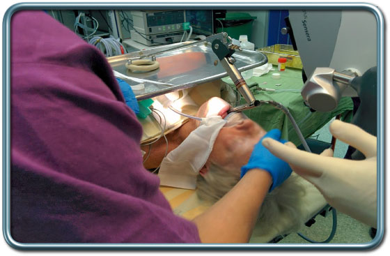 לרינגוסקופיה ישירה לאחר צנרור קנה