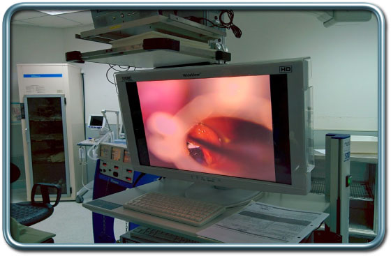 ממצא על מיתרי הקול בלרינגוסקופיה ישירה