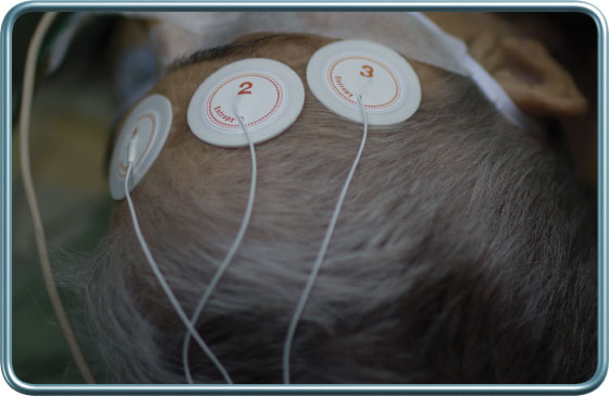 ניטור אנטרופי- Entropy