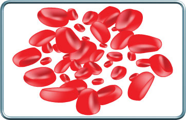 סיבוכים המאטולוגים