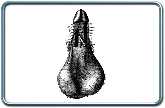 תיקון היפוספאדיאס