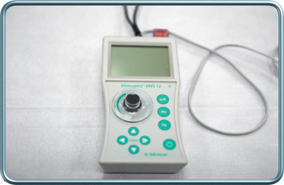 nerve stimulator- מגרה עצב חשמלי