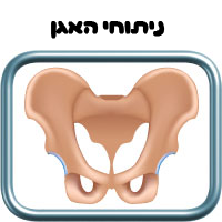 ניתוחי האגן הרדמה לניתוחי אגן