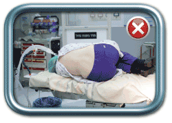 מנח שכיבה לא תקין לאפידורל