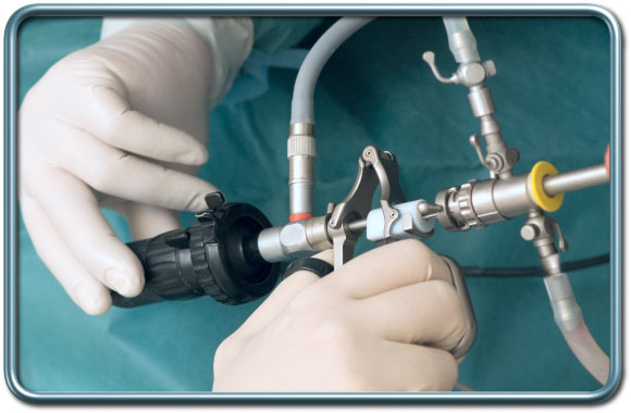 רסקטוסקופ- resectoscope רסקטוסקופ- Resectoscope