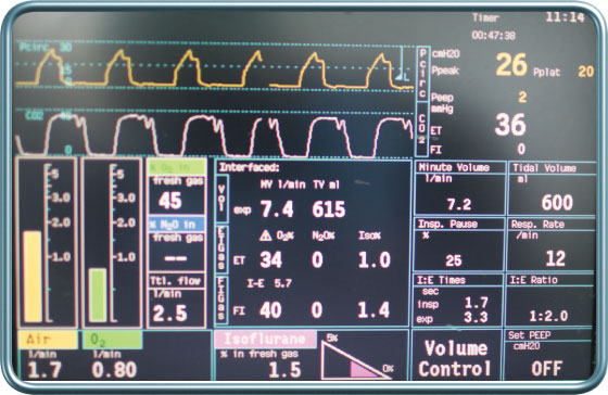 מדדי ניטור נשימתיים