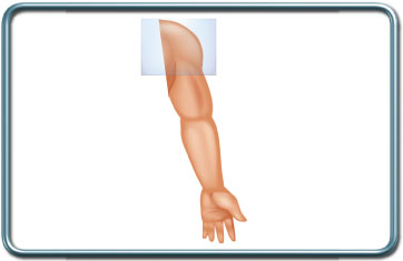 ניתוחי כתף- Shoulder surgery