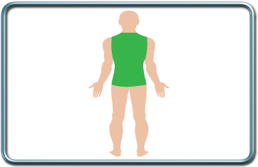 חסמים עצביים של הגו- trunk nerve blocks