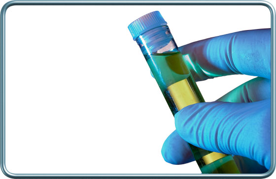 מבחנה לבדיקת שתן